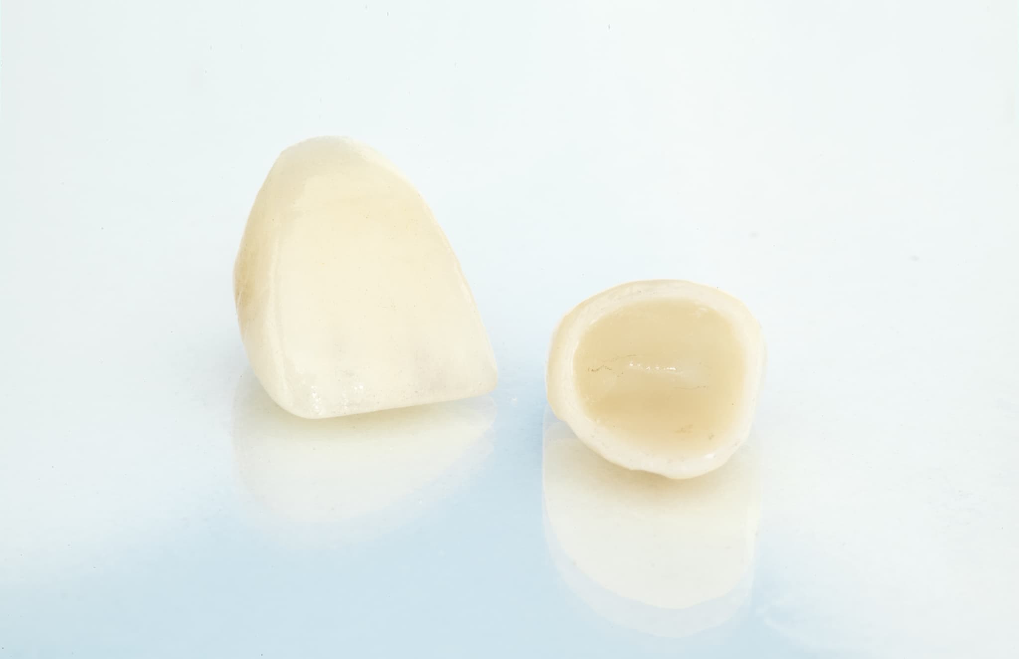仮歯の作成